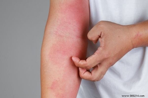 10 Science-Backed Health Benefits of Turmeric for Everyday Wellness