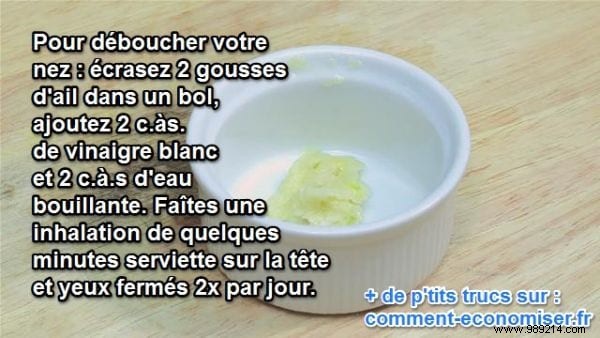 Unclog a Stuffy Nose Fast: Proven Natural Garlic Inhalation Remedy