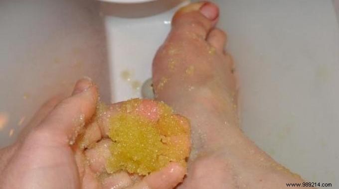 Revive Dry, Cracked Feet Overnight: My Grandmother s Proven Honey Remedy