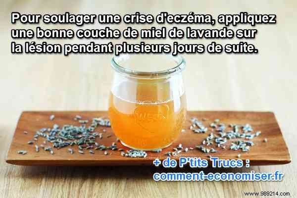 Lavender Honey: A Proven Natural Remedy for Fast Eczema Relief