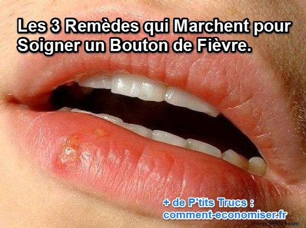 3 Proven Natural Remedies to Quickly Heal Cold Sores