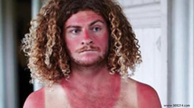 Soothe Sunburn Fast: Earl Grey Tea Bags for Quick Relief