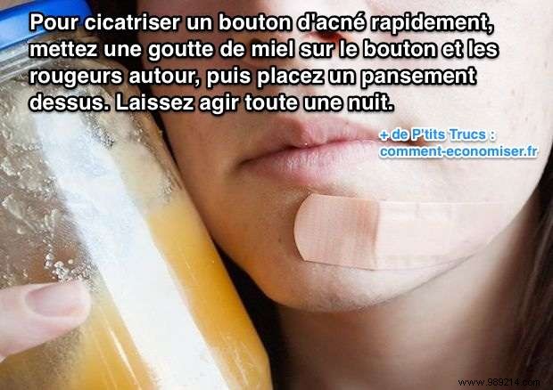 Heal Pimples Overnight: The Proven Power of Honey as a Natural Remedy