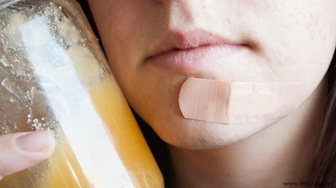 Heal Pimples Overnight: The Proven Power of Honey as a Natural Remedy