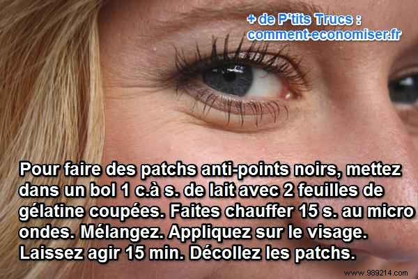 DIY Blackhead Patches: My Simple Homemade Recipe for Clear, Pore-Free Skin