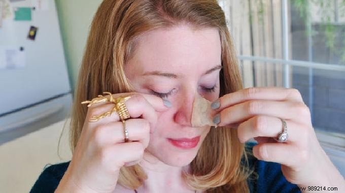 DIY Blackhead Removal Patches: Make Them in 30 Seconds with Kitchen Staples