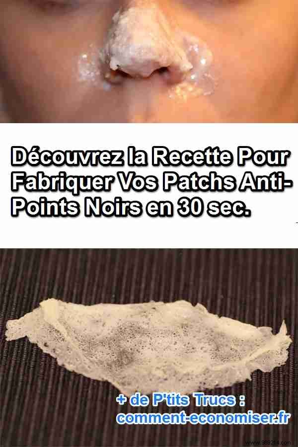 DIY Blackhead Removal Patches: Make Them in 30 Seconds with Kitchen Staples