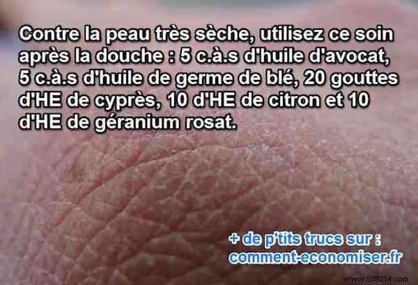 Grandma s Time-Tested Natural Remedy for Severely Dry Skin