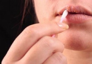 Proven Natural Remedy for Oral Herpes: Niaouli Essential Oil for Fast Relief