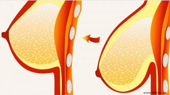 Firm Your Chest Naturally: The Simple Ice Cube Massage Technique