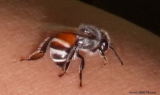 14 Proven Home Remedies for Bee Stings: Fast, Natural Pain Relief