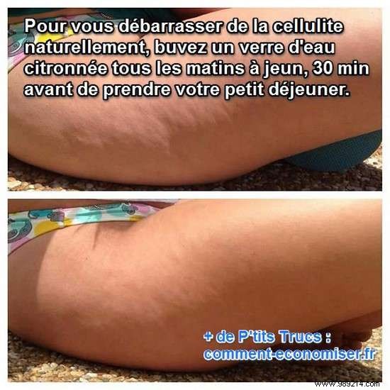 Natural Lemon Water: A Simple Way to Reduce Cellulite
