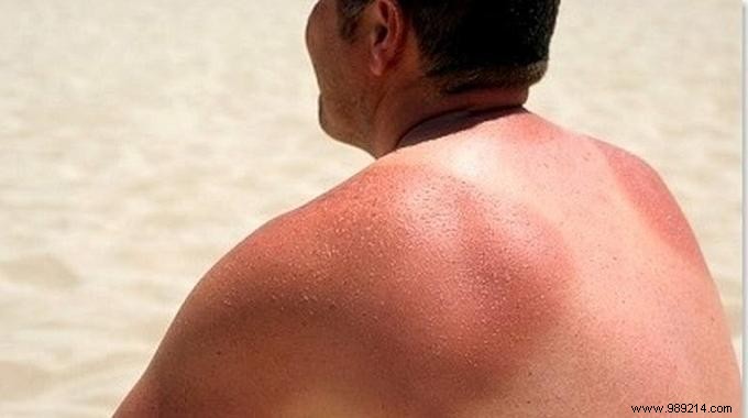 Simple DIY After-Sun Lotion: Cucumber and Almond Oil for Hydrated, Longer-Lasting Tan