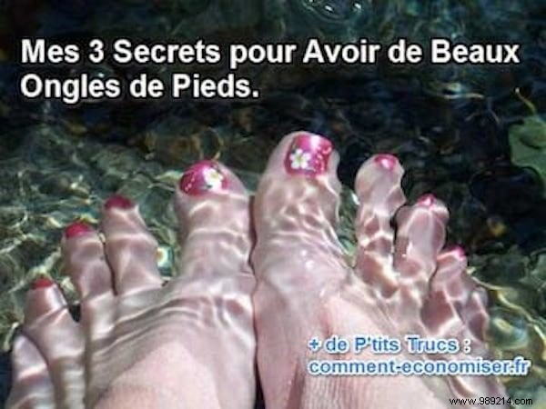 3 Expert Secrets for Beautiful, Healthy Toenails