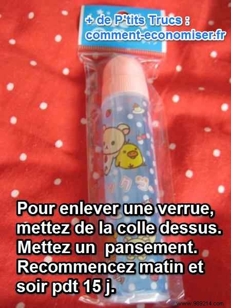 Quick Wart Removal: Proven Glue and Bandage Method from Personal Experience