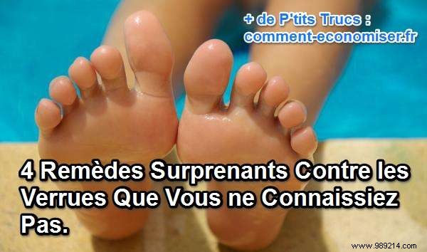 4 Proven Natural Remedies for Warts: Surprising Home Treatments That Work