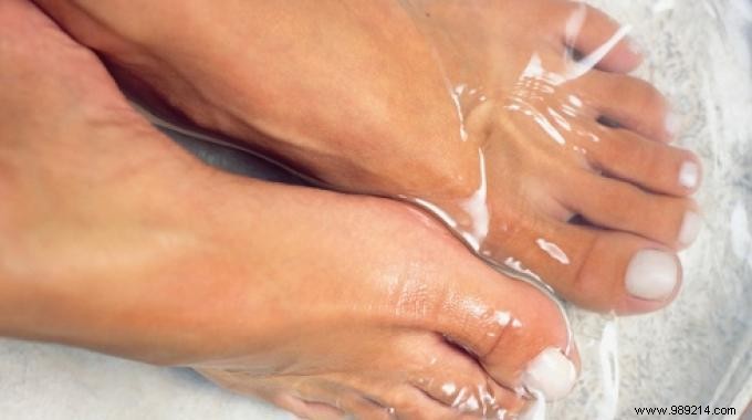 Stop Excessive Foot Sweating Naturally: My Proven Lemon Tea Foot Soak