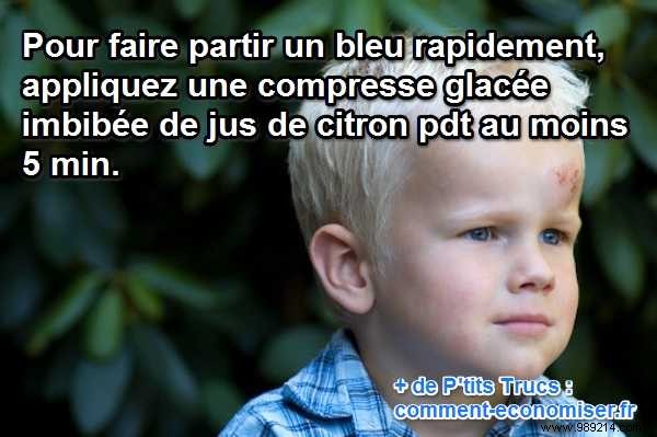 Heal Bruises Fast: Proven Lemon Ice Compress Remedy