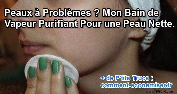 Revive Problematic Skin: My Proven Purifying Facial Steam Bath Recipe