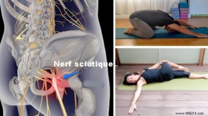 8 Proven Yoga Poses to Relieve Sciatica Pain in Under 15 Minutes