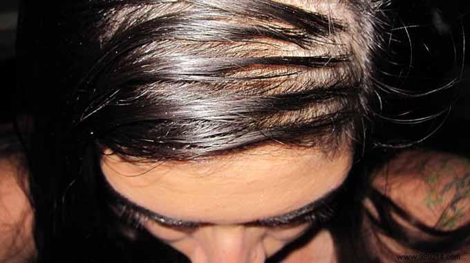 3 Proven Salt Remedies to Banish Oily Hair Effectively
