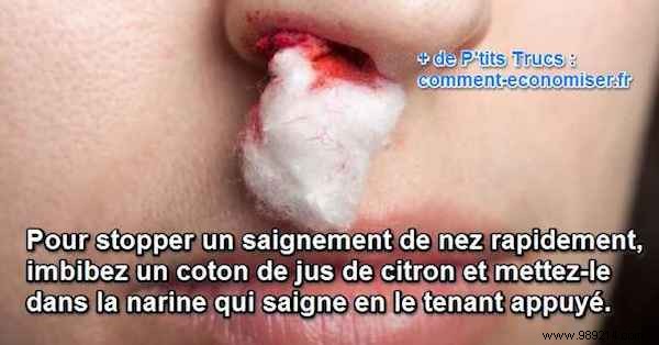 Stop Nosebleeds Fast: Simple Lemon Juice Remedy Backed by Natural Healing Properties