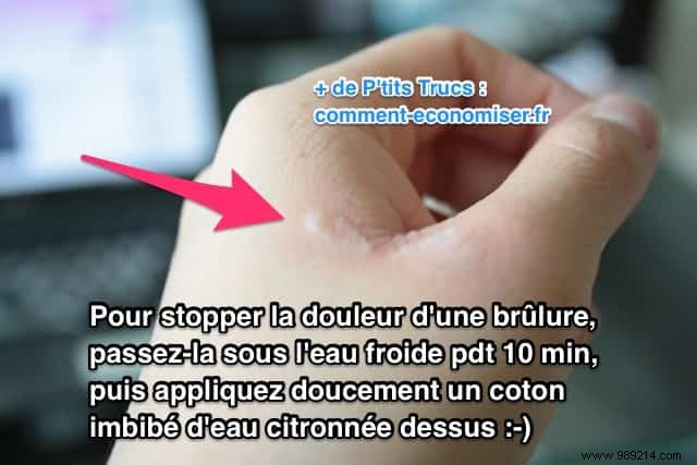 Grandma s Proven Remedy for Instant Minor Burn Relief