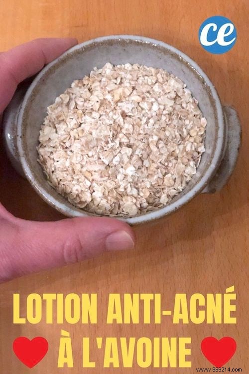 2 Proven Oatmeal Remedies for Fighting Acne Naturally