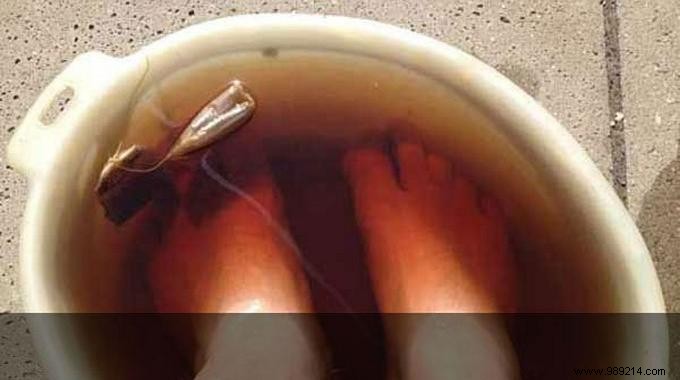 Eliminate Sweaty Feet Naturally: The Proven Tea and Lemon Foot Bath Remedy