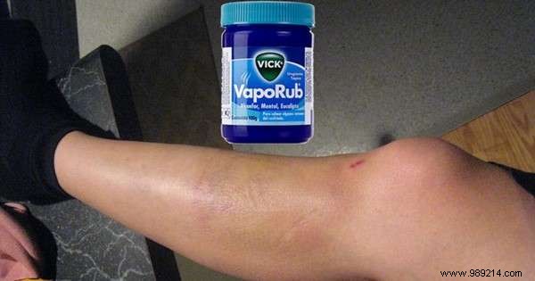 18 Proven Vicks VapoRub Uses for Coughs, Pain Relief, Skin Care, and More