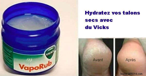 18 Proven Vicks VapoRub Uses for Coughs, Pain Relief, Skin Care, and More