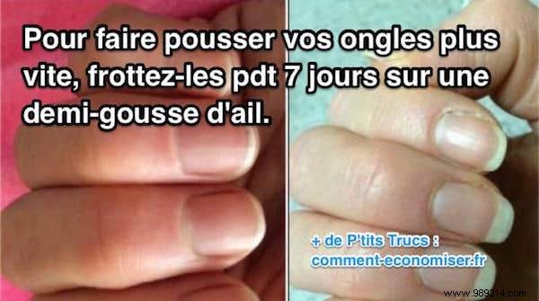 Grandma s Proven Garlic Remedy: Grow Stronger, Longer Nails Faster