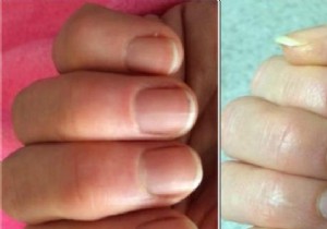 Grandma s Proven Garlic Remedy: Grow Stronger, Longer Nails Faster