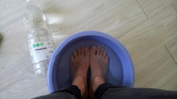Quick Relief for Sore or Swollen Feet: The Simple Vinegar Foot Bath Remedy