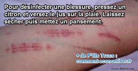 Lemon Juice: A Time-Tested Natural Antiseptic for Minor Wounds