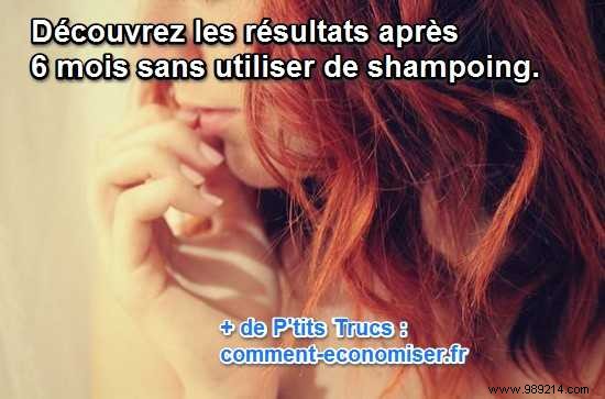 6 Months Shampoo-Free: My Honest Experience with Baking Soda and Vinegar