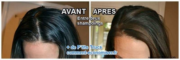 6 Months Shampoo-Free: My Honest Experience with Baking Soda and Vinegar