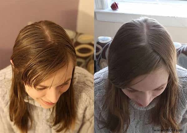 6 Months Shampoo-Free: My Honest Experience with Baking Soda and Vinegar