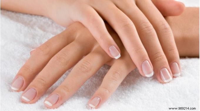 5 Proven Natural Ways to Stop Nail Biting for Good