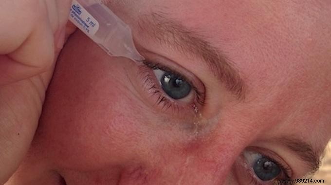 The Simple, Foolproof Trick for Applying Eye Drops Effortlessly