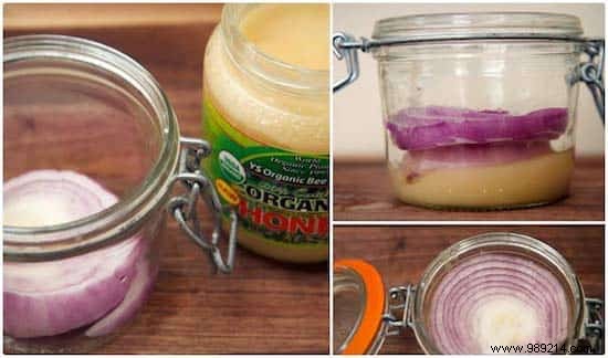 14 Proven Natural Remedies for Fast Cold Relief