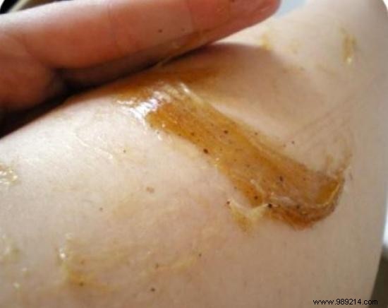 Unlock Radiant Skin: The Proven Benefits of Authentic Black Soap