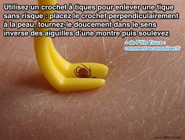 Safe Tick Removal: Proven Step-by-Step Guide Using a Tick Hook