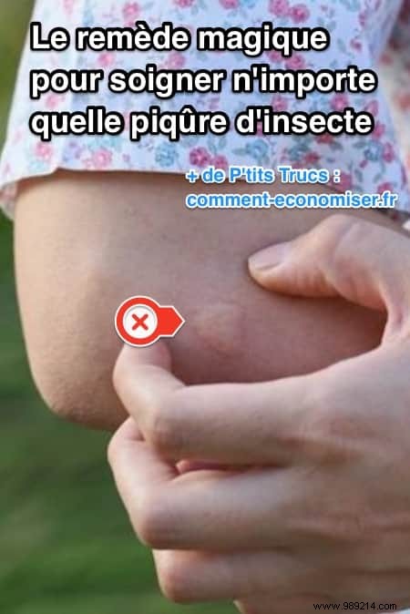 Fast Relief for Insect Bites: Baking Soda and Vinegar Home Remedy