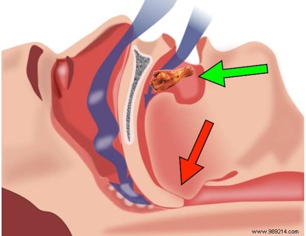 10 Proven Home Remedies to Stop Snoring Tonight for Better Sleep