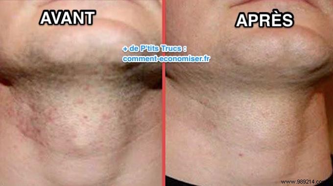 Ditch Store-Bought Aftershave: Soothe Razor Burn Naturally with Baking Soda