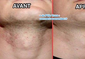 Ditch Store-Bought Aftershave: Soothe Razor Burn Naturally with Baking Soda