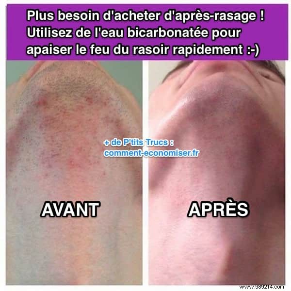 Ditch Store-Bought Aftershave: Soothe Razor Burn Naturally with Baking Soda