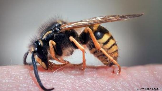 Proven Home Remedy for Wasp Sting Relief: Fast and Effective Treatment
