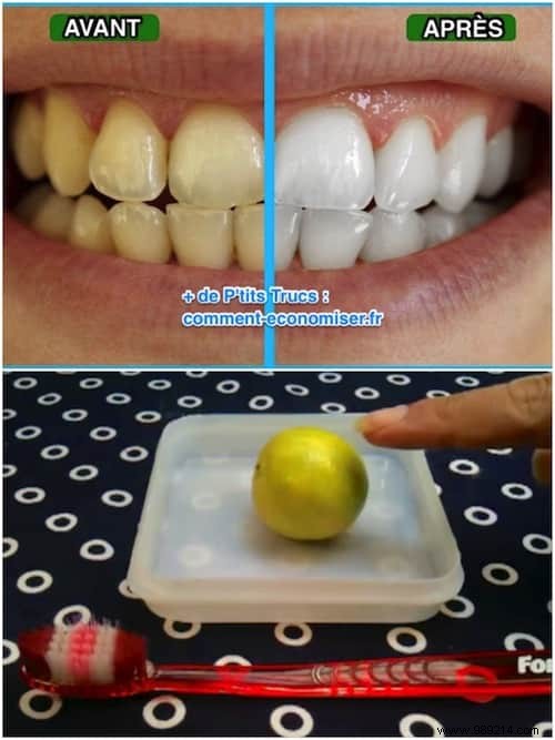 Natural Teeth Whitening at Home: Proven Lemon Juice Method for a Brighter Smile